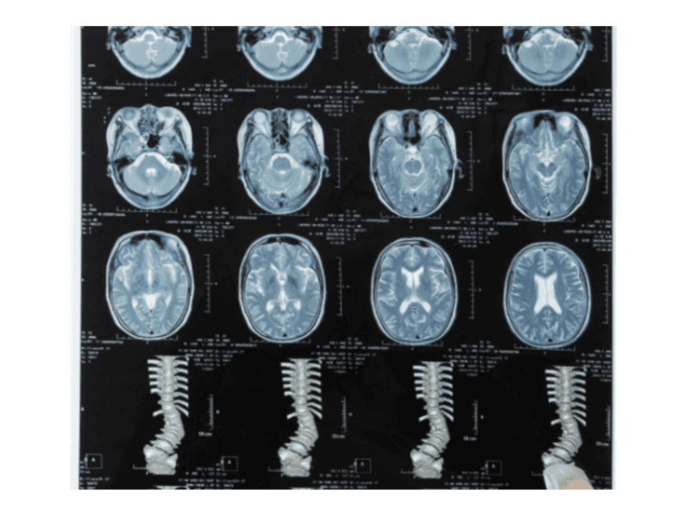 Dry Imaging x Ray Films