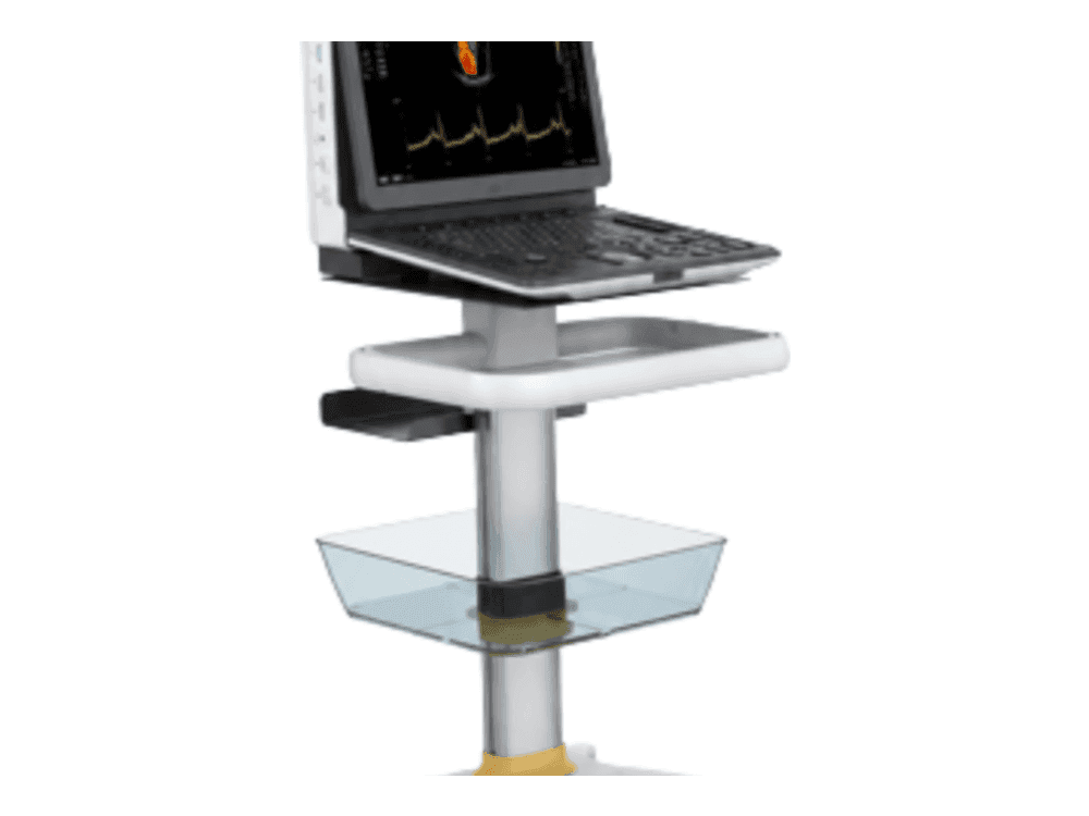 M30 Portable Ultrasound
